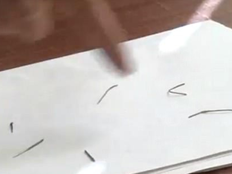 بالصور: عشر إبر في جسد طفلٍ رضيع!